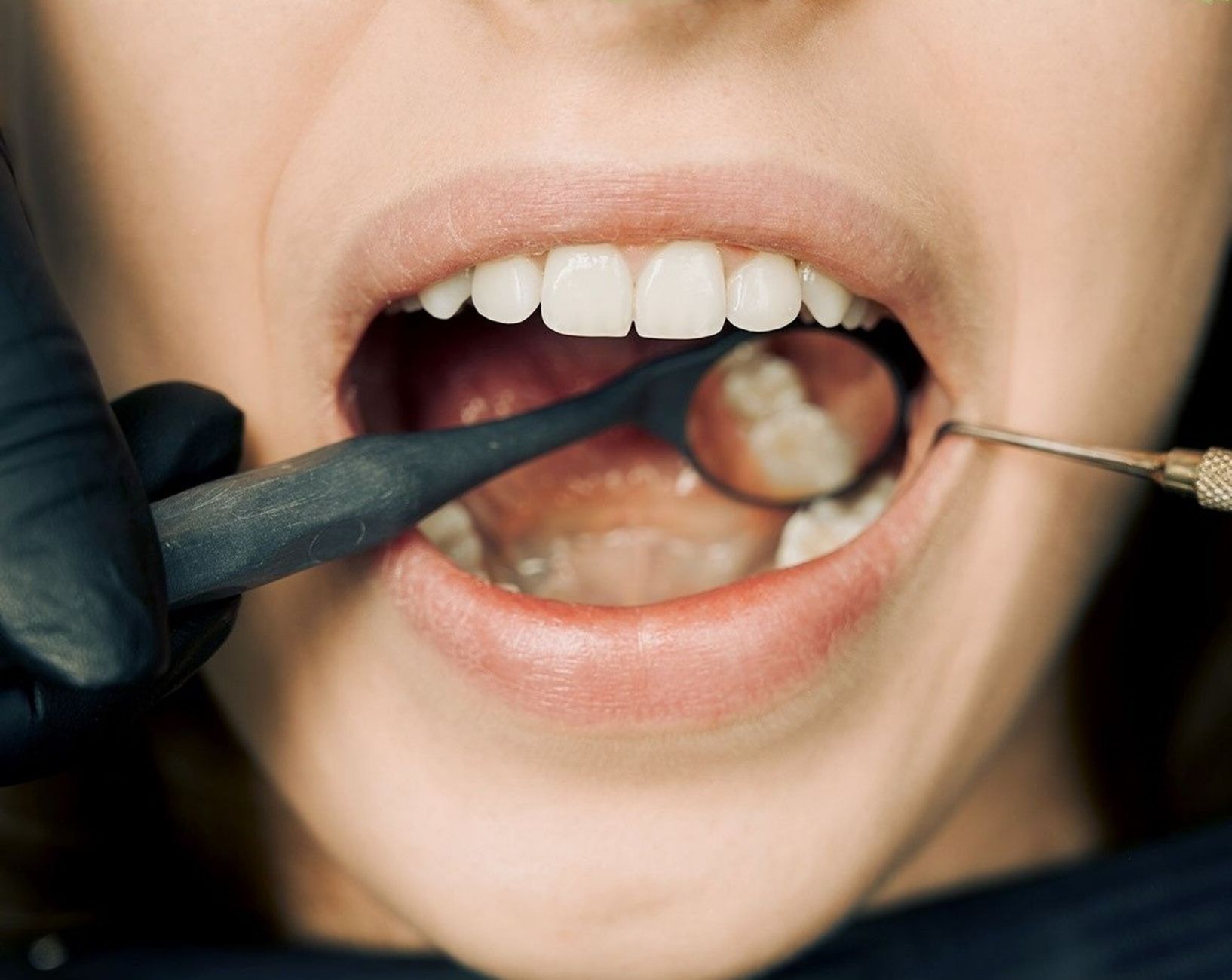dentist checking gums patient