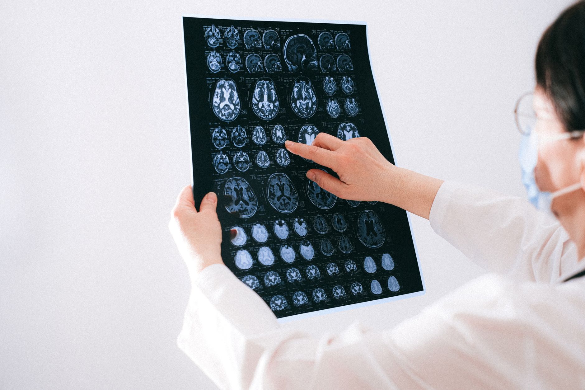 brain health neurology consultation