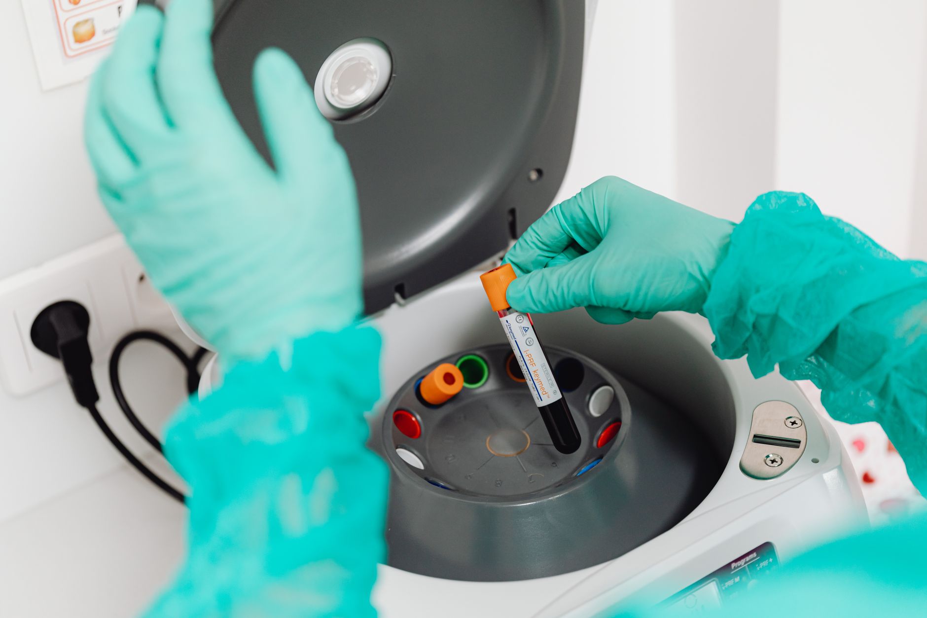 blood test medical laboratory