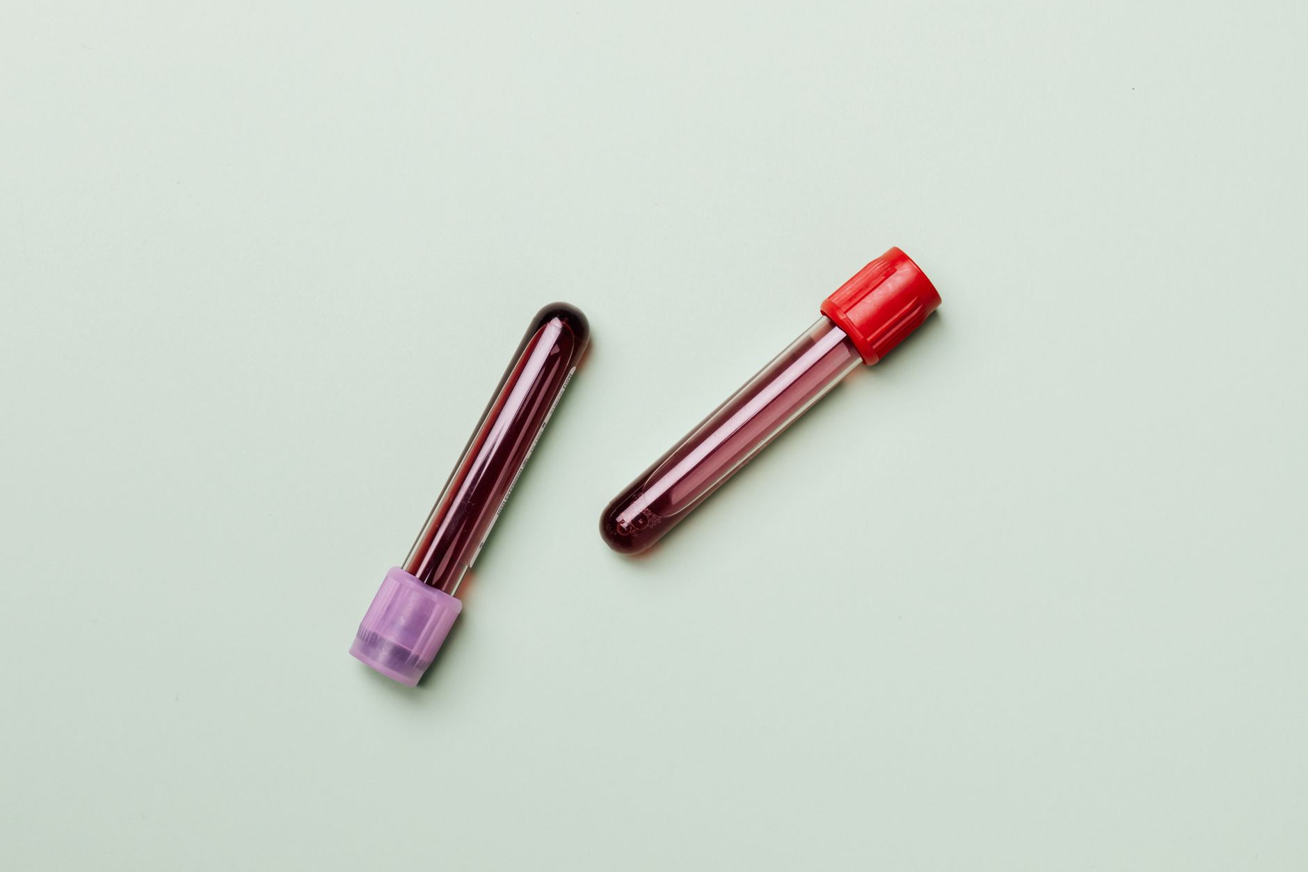 blood test laboratory tube