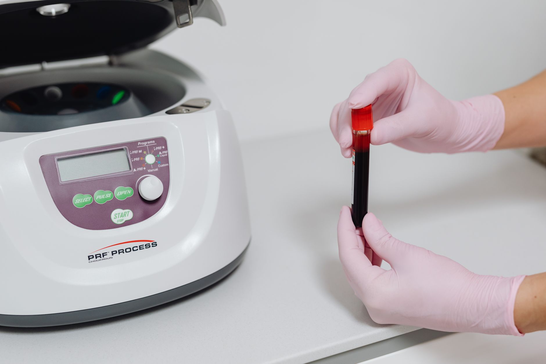 medical blood plasma procedure