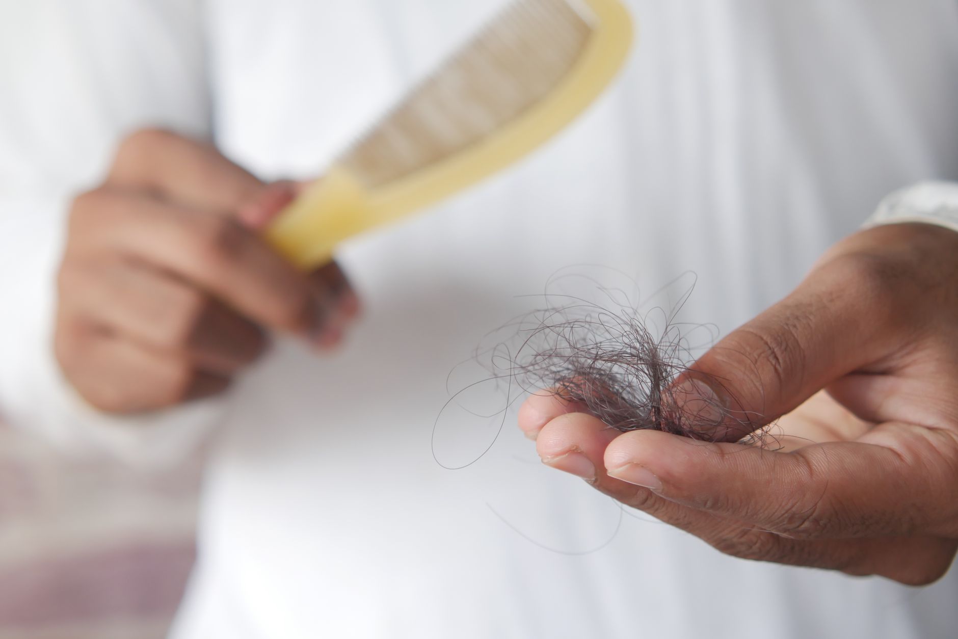 hair loss examination scalp