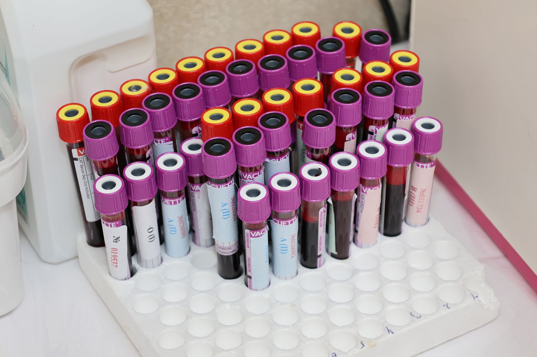 laboratory blood test tubes