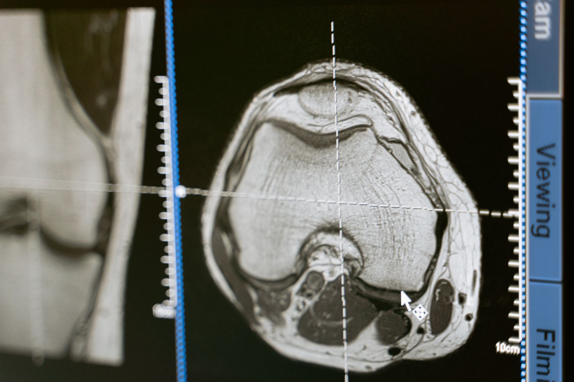 MRI scan medical imaging